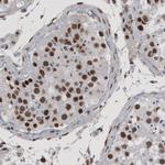 hnRNP C Antibody in Immunohistochemistry (Paraffin) (IHC (P))