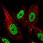 hnRNP C Antibody in Immunocytochemistry (ICC/IF)