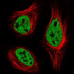 hnRNP C Antibody in Immunocytochemistry (ICC/IF)