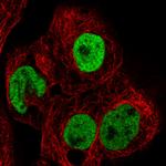 hnRNP C Antibody in Immunocytochemistry (ICC/IF)