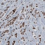 hnRNP C Antibody in Immunohistochemistry (Paraffin) (IHC (P))