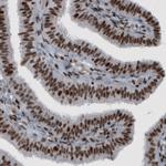 hnRNP C Antibody in Immunohistochemistry (Paraffin) (IHC (P))