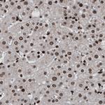 hnRNP C Antibody in Immunohistochemistry (Paraffin) (IHC (P))