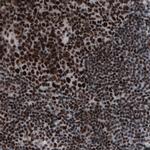 hnRNP C Antibody in Immunohistochemistry (Paraffin) (IHC (P))