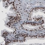 hnRNP C Antibody in Immunohistochemistry (Paraffin) (IHC (P))