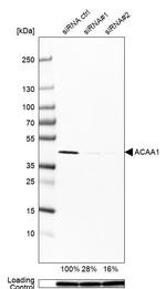 ACAA1 Antibody