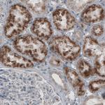 ACAA1 Antibody in Immunohistochemistry (Paraffin) (IHC (P))