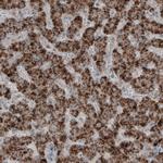 ACAA1 Antibody in Immunohistochemistry (Paraffin) (IHC (P))