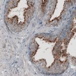 ACAA1 Antibody in Immunohistochemistry (Paraffin) (IHC (P))