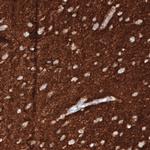 VGLUT1 Antibody in Immunohistochemistry (Paraffin) (IHC (P))