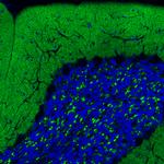 VGLUT1 Antibody in Immunohistochemistry (Paraffin) (IHC (P))