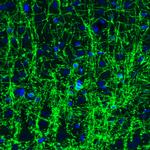 CNPase Antibody in Immunohistochemistry (Paraffin) (IHC (P))