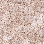 CNPase Antibody in Immunohistochemistry (Paraffin) (IHC (P))