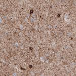 GAD67 Antibody in Immunohistochemistry (Paraffin) (IHC (P))