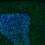 VGLUT2 Antibody in Immunohistochemistry (Paraffin) (IHC (P))