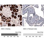 DOPA Decarboxylase Antibody