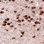 DOPA Decarboxylase Antibody in Immunohistochemistry (Paraffin) (IHC (P))