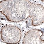 Laminin alpha-1 Antibody in Immunohistochemistry (Paraffin) (IHC (P))