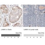 Laminin alpha-1 Antibody