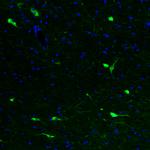 ChAT Antibody in Immunohistochemistry (Paraffin) (IHC (P))