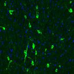 ChAT Antibody in Immunohistochemistry (Paraffin) (IHC (P))