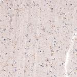 ChAT Antibody in Immunohistochemistry (Paraffin) (IHC (P))