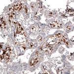 ChAT Antibody in Immunohistochemistry (Paraffin) (IHC (P))