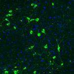 ChAT Antibody in Immunohistochemistry (Paraffin) (IHC (P))