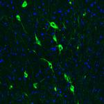 ChAT Antibody in Immunohistochemistry (Paraffin) (IHC (P))