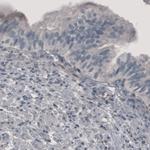 PGM1 Antibody in Immunohistochemistry (Paraffin) (IHC (P))