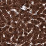 PGM1 Antibody in Immunohistochemistry (Paraffin) (IHC (P))