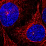 CEP350 Antibody in Immunocytochemistry (ICC/IF)