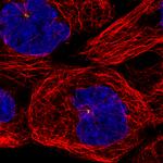 CEP350 Antibody in Immunocytochemistry (ICC/IF)