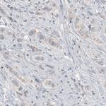 CEP350 Antibody in Immunohistochemistry (Paraffin) (IHC (P))