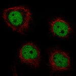 GRHL2 Antibody in Immunocytochemistry (ICC/IF)