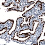 GRHL2 Antibody in Immunohistochemistry (Paraffin) (IHC (P))