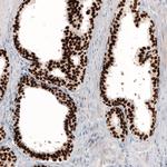 GRHL2 Antibody in Immunohistochemistry (Paraffin) (IHC (P))