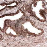 Cyclophilin B Antibody in Immunohistochemistry (Paraffin) (IHC (P))