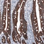 OTC Antibody in Immunohistochemistry (Paraffin) (IHC (P))