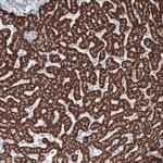 OTC Antibody in Immunohistochemistry (Paraffin) (IHC (P))