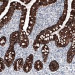 OTC Antibody in Immunohistochemistry (Paraffin) (IHC (P))