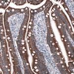 OTC Antibody in Immunohistochemistry (Paraffin) (IHC (P))