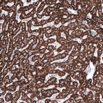 OTC Antibody in Immunohistochemistry (Paraffin) (IHC (P))