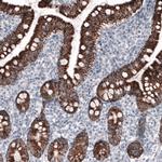 OTC Antibody in Immunohistochemistry (Paraffin) (IHC (P))