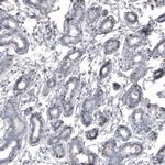 MKL1 Antibody in Immunohistochemistry (Paraffin) (IHC (P))