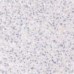 MKL1 Antibody in Immunohistochemistry (Paraffin) (IHC (P))