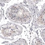 MKL1 Antibody in Immunohistochemistry (Paraffin) (IHC (P))