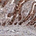 RBCK1 Antibody in Immunohistochemistry (Paraffin) (IHC (P))