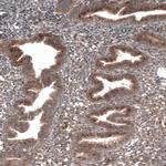 RBCK1 Antibody in Immunohistochemistry (Paraffin) (IHC (P))