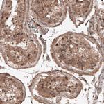 RBCK1 Antibody in Immunohistochemistry (Paraffin) (IHC (P))